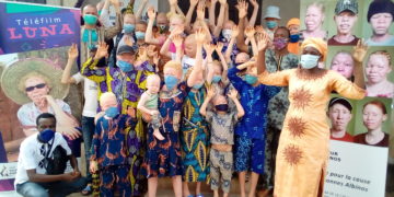 Célébration de la Journée Internationale de l&rsquo;Albinisme, édition 2020: l&rsquo;ONG Valeurs Albinos offre  des kits alimentaires aux Albinos.