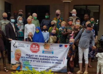 Lutte contre le Covid 19 : l’ONG « VALEUR ALBINOS » offre des kits aux personnes Albinos.