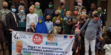 Lutte contre le Covid 19 : l&rsquo;ONG « VALEUR ALBINOS » offre des kits aux personnes Albinos.