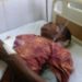 Bénin / Assassinat manqué du Directeur exécutif de l’ONG ALCRER : 07 ans après, l’identité des agresseurs de Martin Assogba toujours inconnue