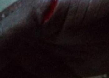 Violence conjugale à Hêvié dans la commune d’Abomey-Calavi : Un homme de 42 ans arrêté pour avoir battu sauvagement sa femme.