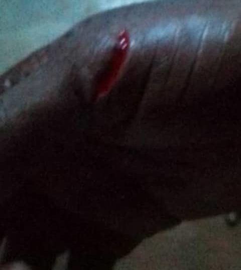 Violence conjugale à Hêvié dans la commune d’Abomey-Calavi : Un homme de 42 ans arrêté pour avoir battu sauvagement sa femme.